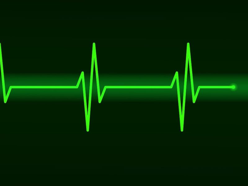 schwarz-grün EKG