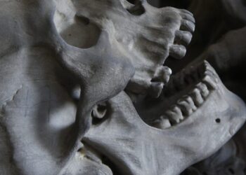 Totenschädel mit lückenhaften Gebiß